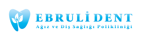 Ebruli Dent | Ana Sayfa
