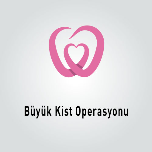 Büyük Kist Operasyonu